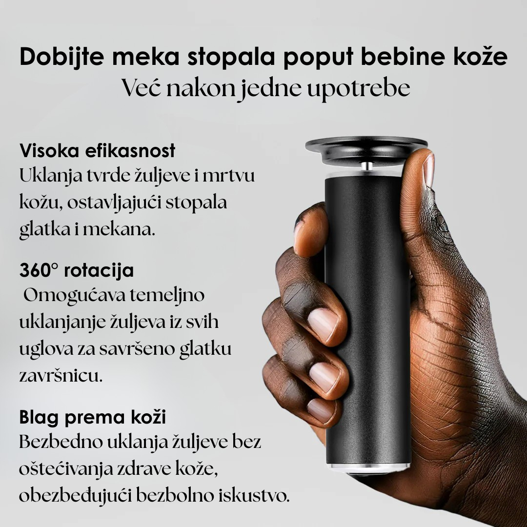 Profesionalna Električna Turpija za Njegu Stopala